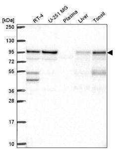 APPL Antibody, Novus Biologicals APPL Antibody; Unconjugated; 100 &mu;L:Antibodies,