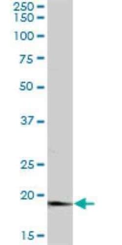 APRT Antibody, Novus Biologicals 0.05 mg | Buy Online | Novus Biologicals | Fisher Scientific