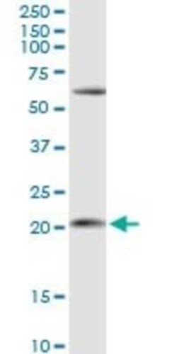 APRT Antibody, Novus Biologicals 0.1 mg | Buy Online | Novus Biologicals | Fisher Scientific