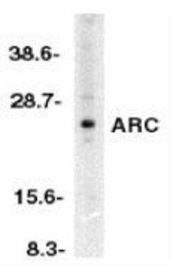 ARC/NOL3 Antibody - BSA Free, Novus Biologicals 0.1 mg; Unconjugated:Antibodies,