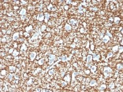 ARF1 Antibody (ARF1/2117) - Azide and BSA Free, Novus Biologicals 100 &mu;g | Buy Online | Novus Biologicals | Fisher Scientific