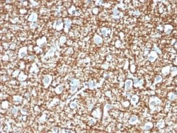 ARF1 Mouse anti-Human, Mouse, Rat, Clone: ARF1/2117, Novus Biologicals:Antibodies:Primary