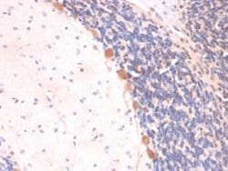 ARF1 Mouse anti-Human, Mouse, Rat, Clone: ARF1/2117, Novus Biologicals:Antibodies:Primary