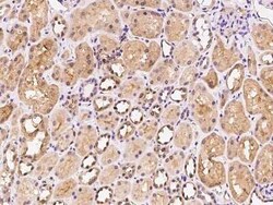 ARF3 Antibody, Novus Biologicals:Antibodies:Primary Antibodies