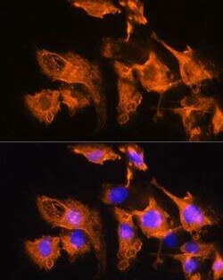 ARF4 Antibody - Azide and BSA Free, Novus Biologicals 0.1 mL, Unconjugated:Antibodies,