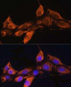 ARF4 Antibody - Azide and BSA Free, Novus Biologicals 0.1 mL, Unconjugated:Antibodies,
