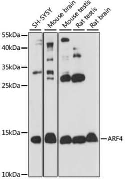 ARF4 Antibody - Azide and BSA Free, Novus Biologicals 0.1 mL, Unconjugated:Antibodies,