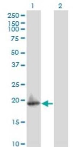 ARF5 Antibody (1B6), Novus Biologicals 0.1 mg | Buy Online | Novus Biologicals | Fisher Scientific