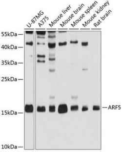 ARF5 Antibody - BSA Free, Novus Biologicals:Antibodies:Primary Antibodies