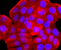 ARF6 Rabbit anti-Human, Clone: JF101-2, Novus Biologicals 100&mu;L:Antibodies,