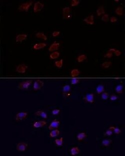 ARF6 Antibody - BSA Free, Novus Biologicals 0.02 mL, Unconjugated:Antibodies,
