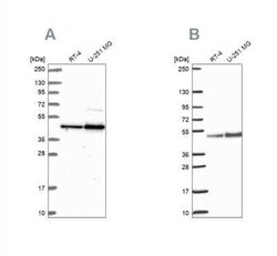 ARFGAP1 Antibody, Novus Biologicals 25 &mu;L; Unconjugated:Antibodies,