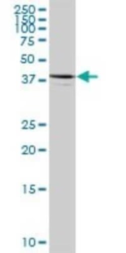 ARFIP1 Antibody, Novus Biologicals 0.05 mg | Buy Online | Novus Biologicals | Fisher Scientific