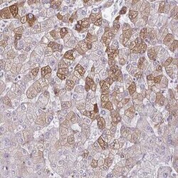 ARH Antibody, Novus Biologicals 0.1 mL, Unconjugated:Antibodies, Polyclonal