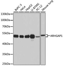 ARHGAP1 Antibody - Azide and BSA Free, Novus Biologicals 0.02 mL, Unconjugated:Antibodies,