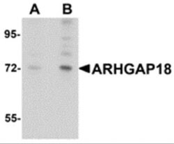 ARHGAP18 Antibody - BSA Free, Novus Biologicals 0.1 mg | Buy Online | Novus Biologicals | Fisher Scientific