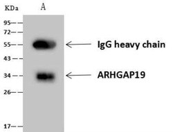 ARHGAP19 Antibody, Novus Biologicals 50 &mu;g; Unconjugated:Antibodies,