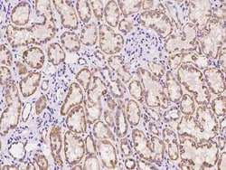 ARHGAP22 Antibody, Novus Biologicals 50 &mu;g, Unconjugated:Antibodies,