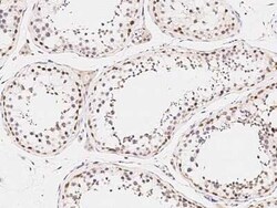 ARHGAP28 Antibody, Novus Biologicals 100 &mu;g | Buy Online | Novus Biologicals | Fisher Scientific