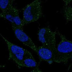 ARHGDIG Antibody, Novus Biologicals:Antibodies:Primary Antibodies
