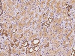 ARHGEF39 Antibody, Novus Biologicals:Antibodies:Primary Antibodies