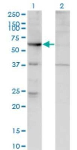 ARHGEF5 Antibody (4D10-D11), Novus Biologicals 0.1 mg | Buy Online | Novus Biologicals | Fisher Scientific