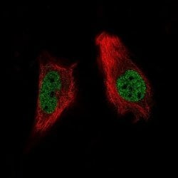 ARID1A Antibody (CL3595), Novus Biologicals 100&mu;L:Antibodies, Monoclonal