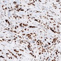 ARID1A Antibody (CL3595), Novus Biologicals 100&mu;L:Antibodies, Monoclonal