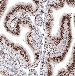 ARID1A Antibody (CL3595), Novus Biologicals 100&mu;L:Antibodies, Monoclonal