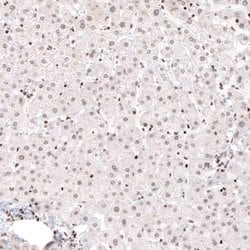 ARID1A Antibody (CL3595), Novus Biologicals 100&mu;L:Antibodies, Monoclonal