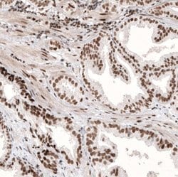 ARID1A Antibody (CL3595), Novus Biologicals 100&mu;L:Antibodies, Monoclonal