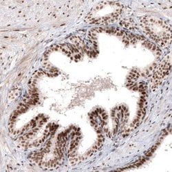 ARID1A Antibody (CL3595), Novus Biologicals 100&mu;L:Antibodies, Monoclonal