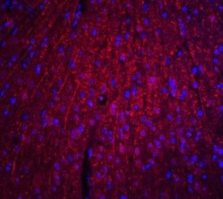 ARID1A Antibody - BSA Free, Novus Biologicals 0.1 mg; Unconjugated:Antibodies,