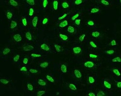 ARID2 Antibody, Novus Biologicals 50 &mu;g; Unconjugated:Antibodies, Polyclonal