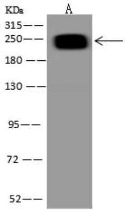 ARID2 Antibody, Novus Biologicals 50 &mu;g; Unconjugated:Antibodies, Polyclonal