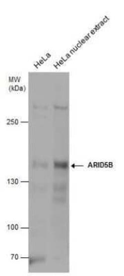 ARID5B Antibody, Novus Biologicals 100 &mu;g | Buy Online | Novus Biologicals | Fisher Scientific