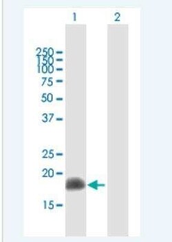 ARL2 Antibody, Novus Biologicals 50 &mu;g | Buy Online | Novus Biologicals | Fisher Scientific
