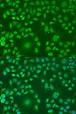 ARL6 Antibody - BSA Free, Novus Biologicals 0.1 mL, Unconjugated:Antibodies,