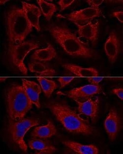 ARL8B Antibody - Azide and BSA Free, Novus Biologicals:Antibodies:Primary