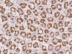 ARMC1 Antibody, Novus Biologicals 50 &mu;g | Buy Online | Novus Biologicals | Fisher Scientific