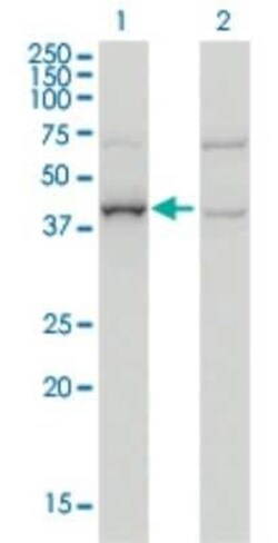 ARMC8 Antibody (2D9), Novus Biologicals 0.1 mg | Buy Online | Novus Biologicals | Fisher Scientific