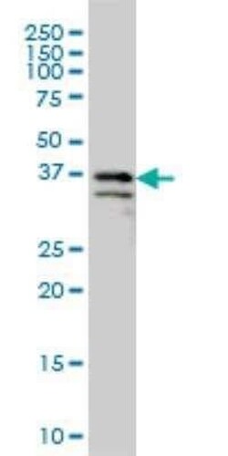 ARMCX3 Antibody (2G3), Novus Biologicals 0.1 mg | Buy Online | Novus Biologicals | Fisher Scientific