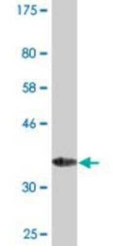 MANF Antibody (1D10), Novus Biologicals 0.1 mg | Buy Online | Novus Biologicals | Fisher Scientific