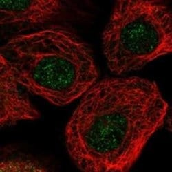 ARPC2 Rabbit anti-Human, Polyclonal, Novus Biologicals 100 &mu;g; Unconjugated:Antibodies,