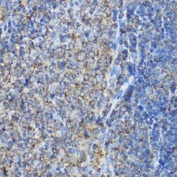 ARPC2 Antibody - Azide and BSA Free, Novus Biologicals 0.02 mL | Buy Online | Novus Biologicals | Fisher Scientific