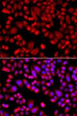 ARPC3 Antibody - BSA Free, Novus Biologicals:Antibodies:Primary Antibodies