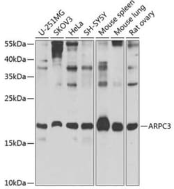 ARPC3 Antibody - BSA Free, Novus Biologicals:Antibodies:Primary Antibodies