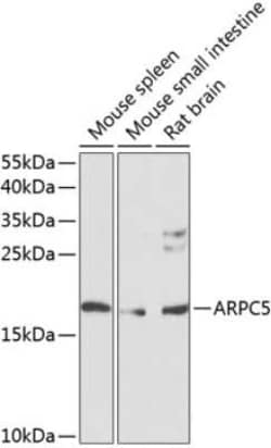 ARPC5 Antibody - BSA Free, Novus Biologicals:Antibodies:Primary Antibodies