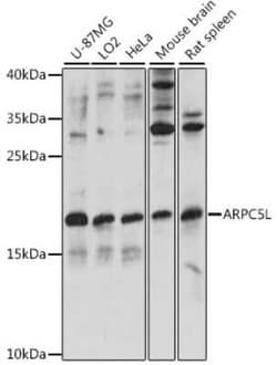 ARPC5L Antibody - Azide and BSA Free, Novus Biologicals 0.02 mL, Unconjugated:Antibodies,