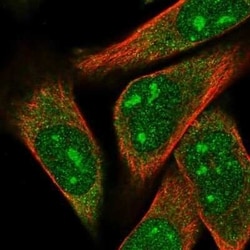 ARPP-21 Antibody, Novus Biologicals 25 &mu;L; Unconjugated:Antibodies,